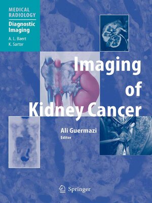 cover image of Imaging of Kidney Cancer